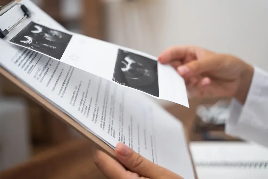 A sonogram attached to a clipboard.